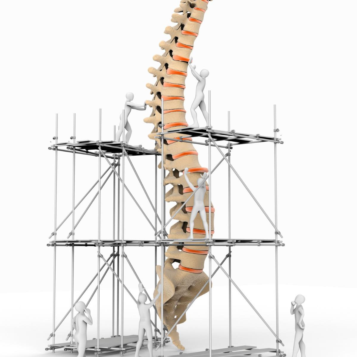 Spinal Stenoz (kanal darlığı) Danışmanlığı (Yüz Yüze)